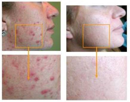 crema bava di lumaca bio effetti
